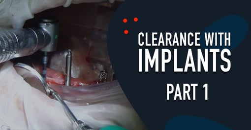 Implant Dental Training Videos