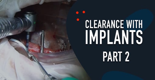 Implant Dental Training Videos