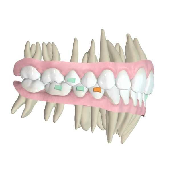 fellowship in aligner orthodontics scan