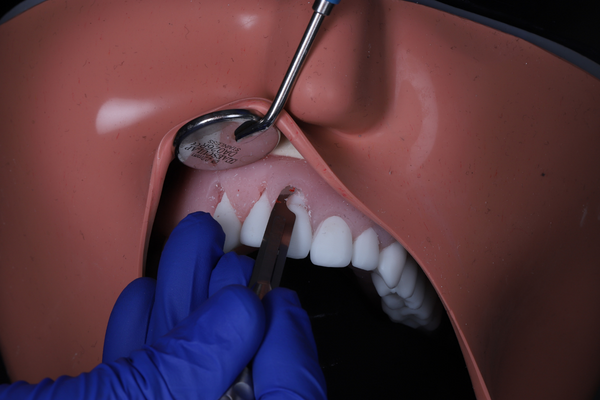 FMI Implantology website imagery (7)