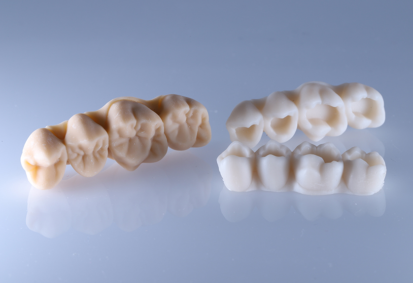 Fillings-model-VHO Fillings-model-VHO
