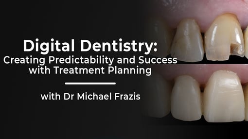 Full Arch Dental Training Videos