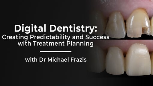 Restorative Indirect Dental Training Videos