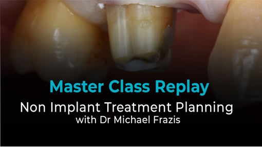 Denture Dental Training Videos