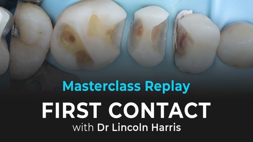 Posterior Dental Training Videos