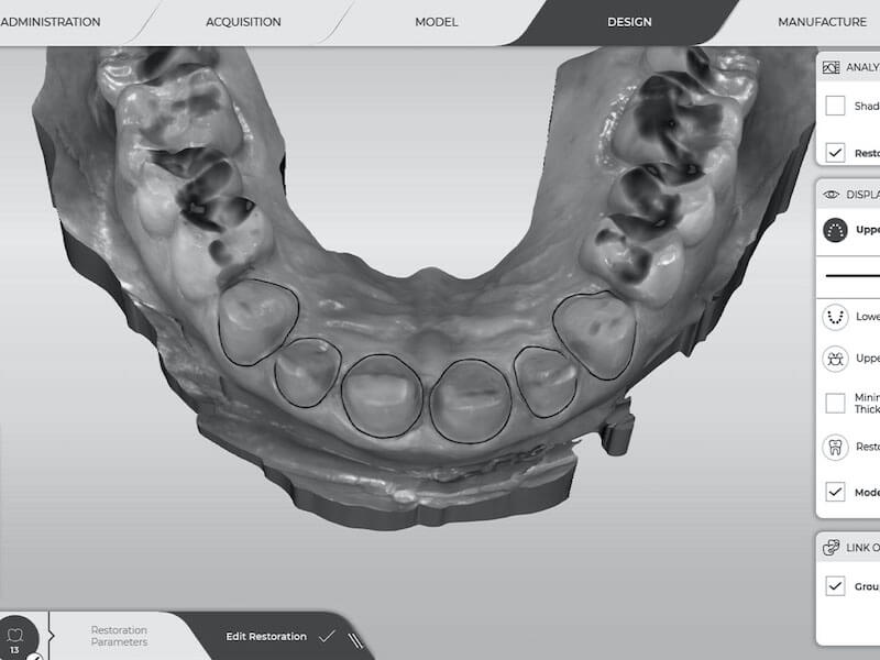 RGG-Digital-Dentistry-images-bw-4x3-5-800x600-opt