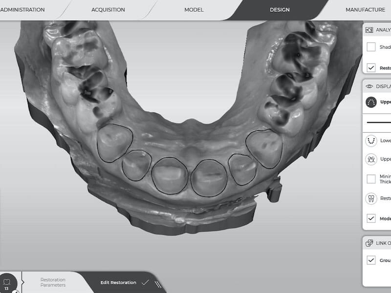 RGG-Digital-Dentistry-images-bw-4x3-5-800x600-opt RGG-Digital-Dentistry-images-bw-4x3-5-800x600-opt