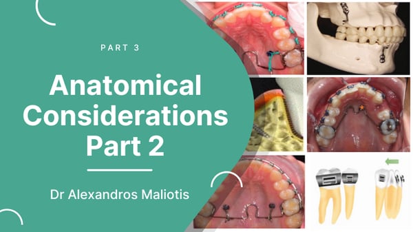 Video-Thumbnail-Alexandros-maliotis-mini-screw-implants-series part 3