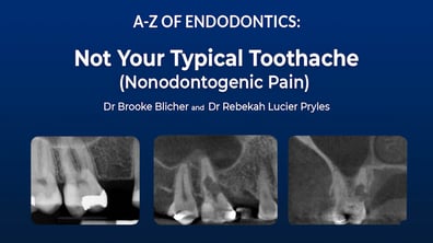 Video-Content-lucier-pryles-blicher-a-z-of-endodontics-series-thumbnail-not-your-typical-toothache-800x450