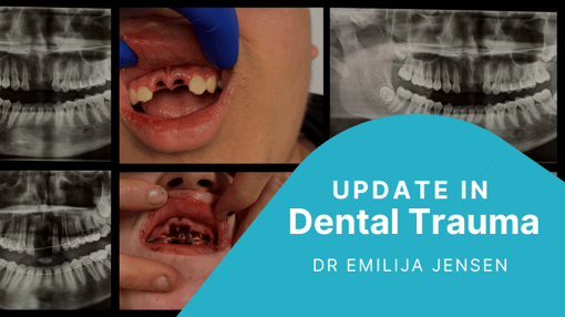 Treatment Planning Dental Training Videos