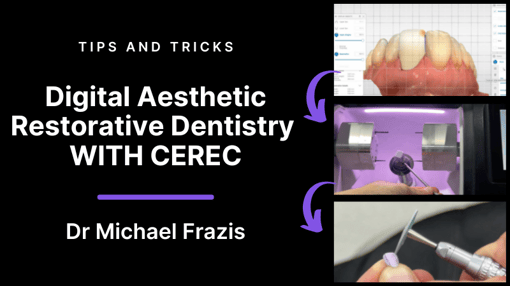 Anterior Dental Training Videos