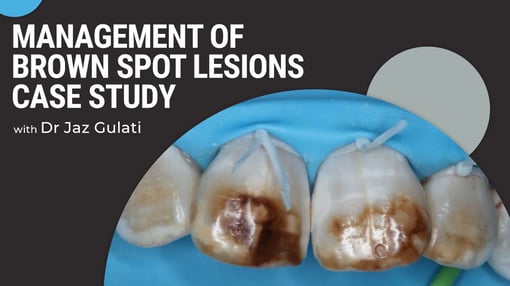Clinical Worflows  Dental Training Videos