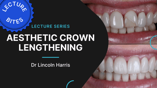 Crown and Bridge Prep Dental Training Videos