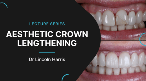 Crown and Bridge Prep Dental Training Videos