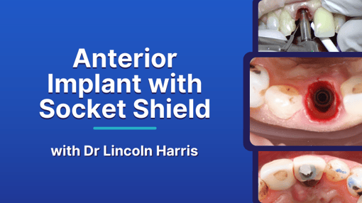 Anterior Dental Training Videos