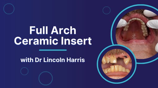 Full Arch Dental Training Videos