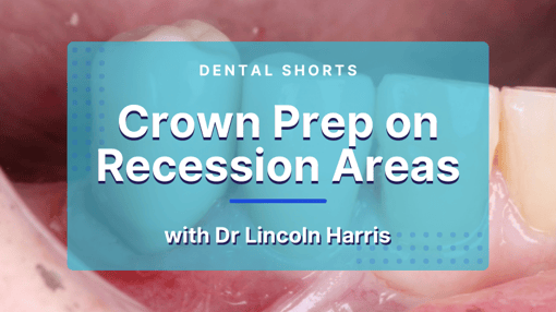 Crown and Bridge Prep Dental Training Videos