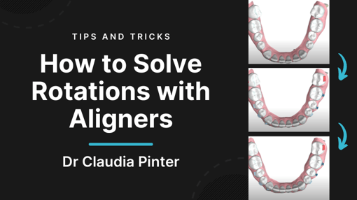 Aligners