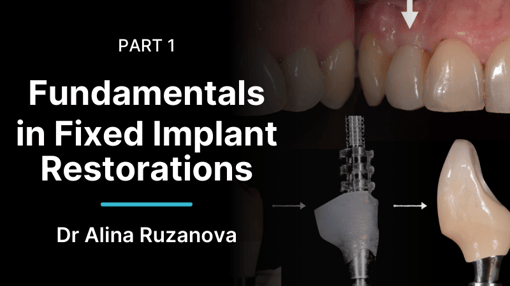 Restorative Indirect Dental Training Videos