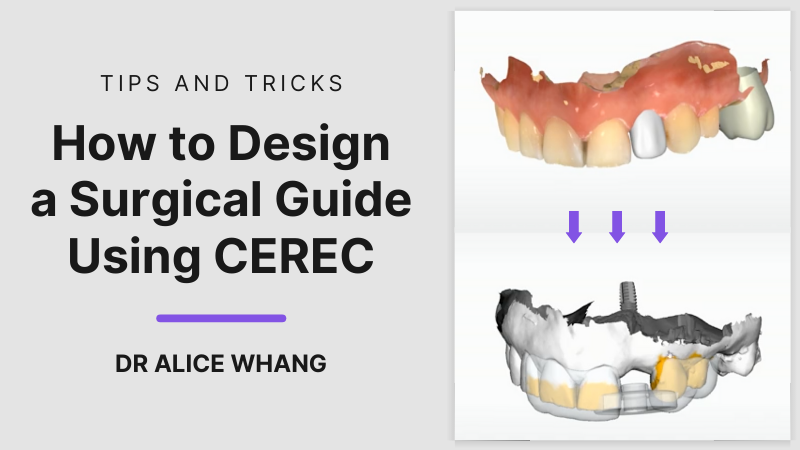 _Video-thumbnail-Whang-7tips-and-tricks-how-to-design-a -surgical-guide-800