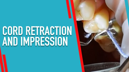 Impressions Dental Training Videos