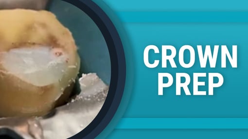 Crown and Bridge Prep Dental Training Videos