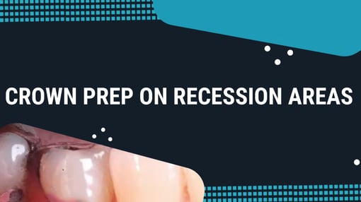 Crown and Bridge Prep Dental Training Videos