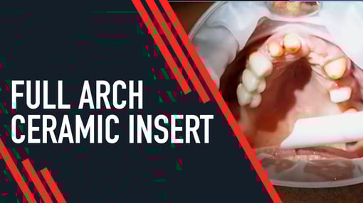 Full Arch Dental Training Videos