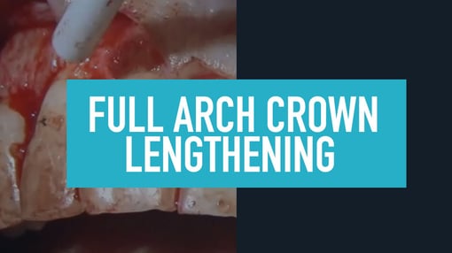 Full Arch Dental Training Videos