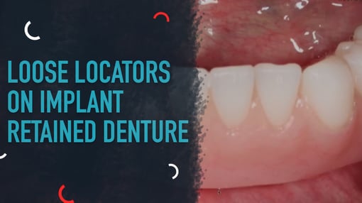 Denture Dental Training Videos