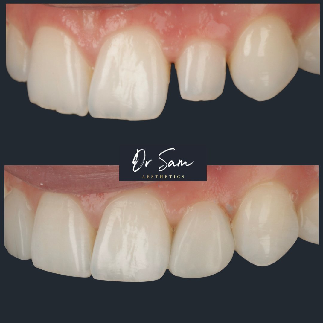 composites 2.001 (1)