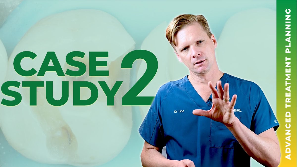 Case 2 - Advanced Treatment Planning