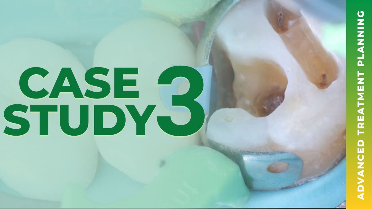 Case 3 - Know Your Patient and Know Yourself - Advanced Treatment Planning