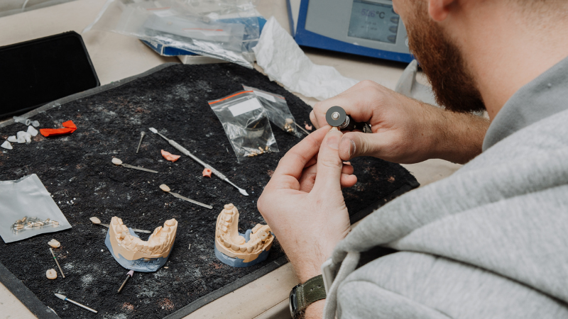 Why Your Crown Scans and Impressions Keep Failing
