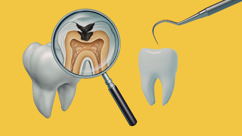 Nerve Injuries in Dentistry: Why They Are More Serious Than Many Dentists Realise