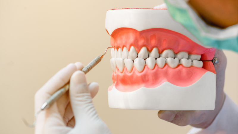 When to Stop Treating One Tooth at a Time and Look at the Full Mouth