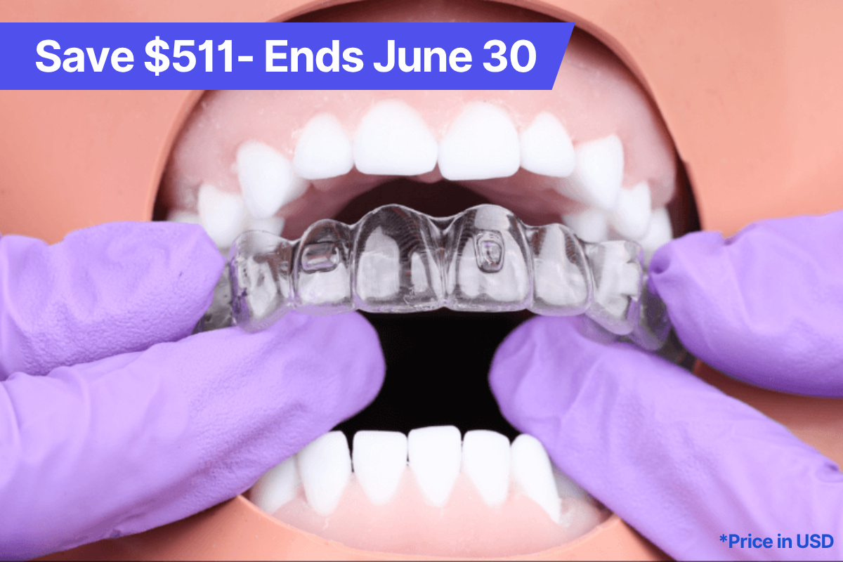 Early Bird Offer - Fellowship in Modern Aligners 10% off, ends May 31 2025-1