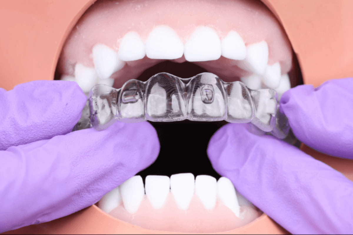 FMA Fellowship in Modern Aligners image  1200x800