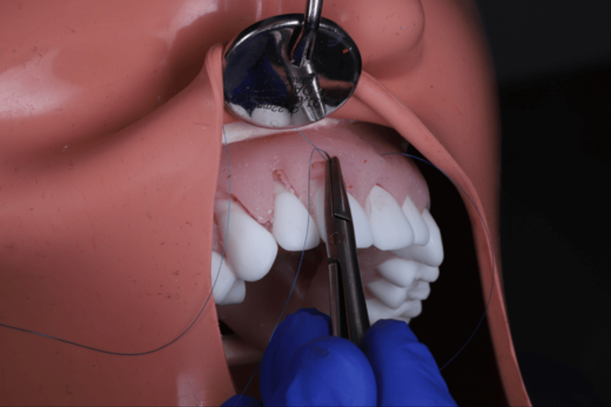 FMI Fellowship in Modern Implantology image 1200x800