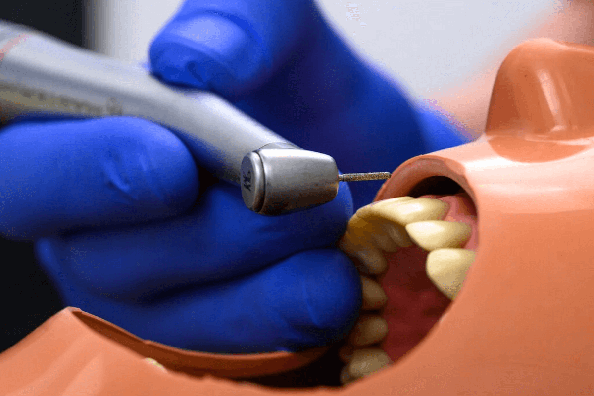 FRD Fellowship in Restorative Dentistry image 1200x800