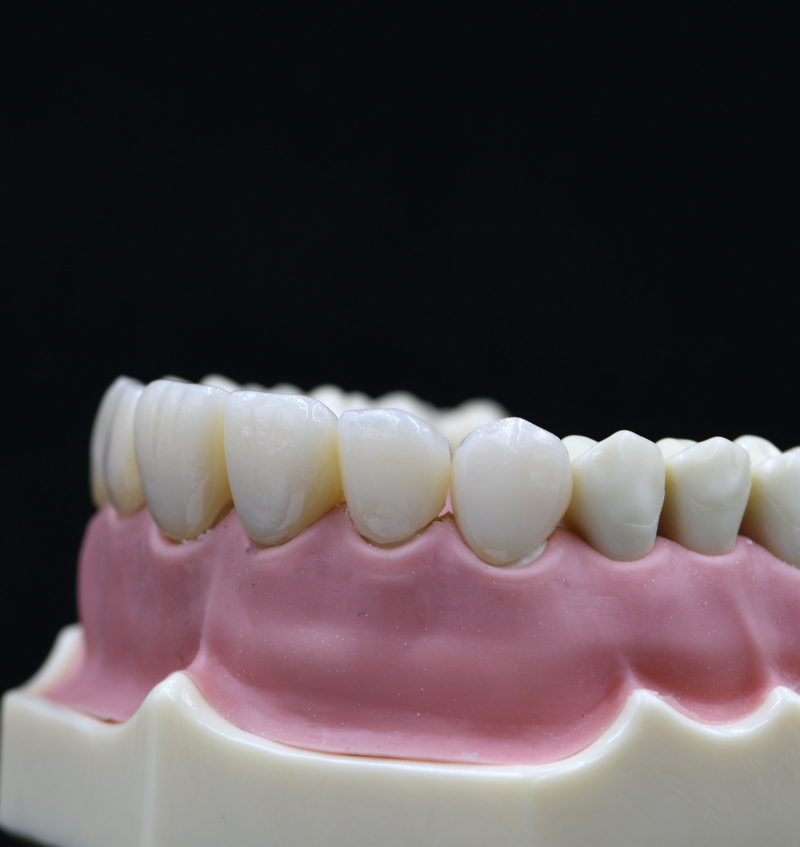 FRD_Veneers_Module_Points_800x847
