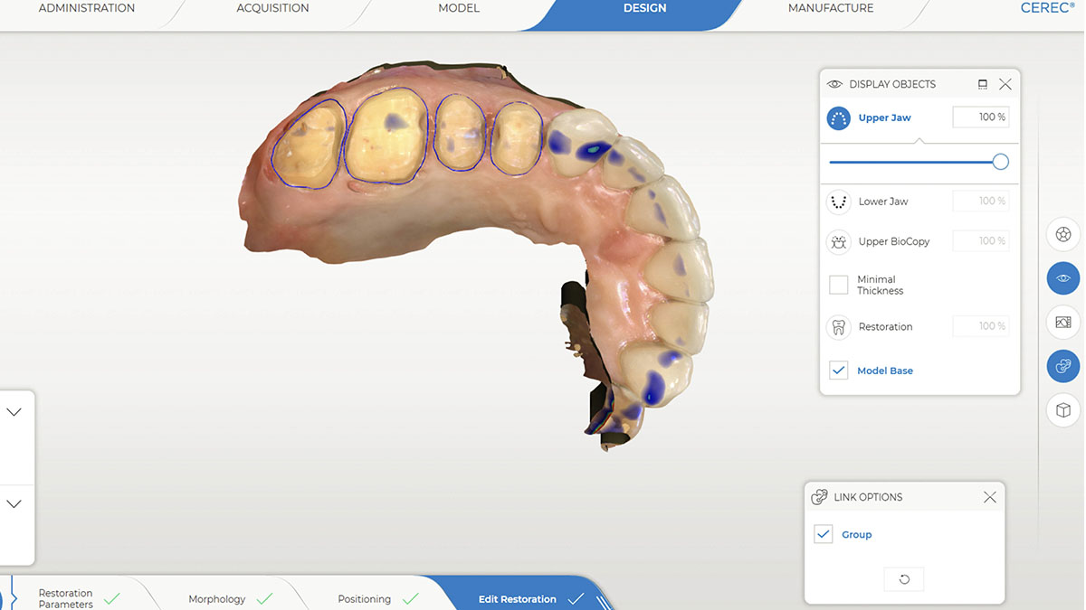 Image-Lincoln-Harris-Digital-Dentistry-CEREC-4-1200x675 Image-Lincoln-Harris-Digital-Dentistry-CEREC-4-1200x675