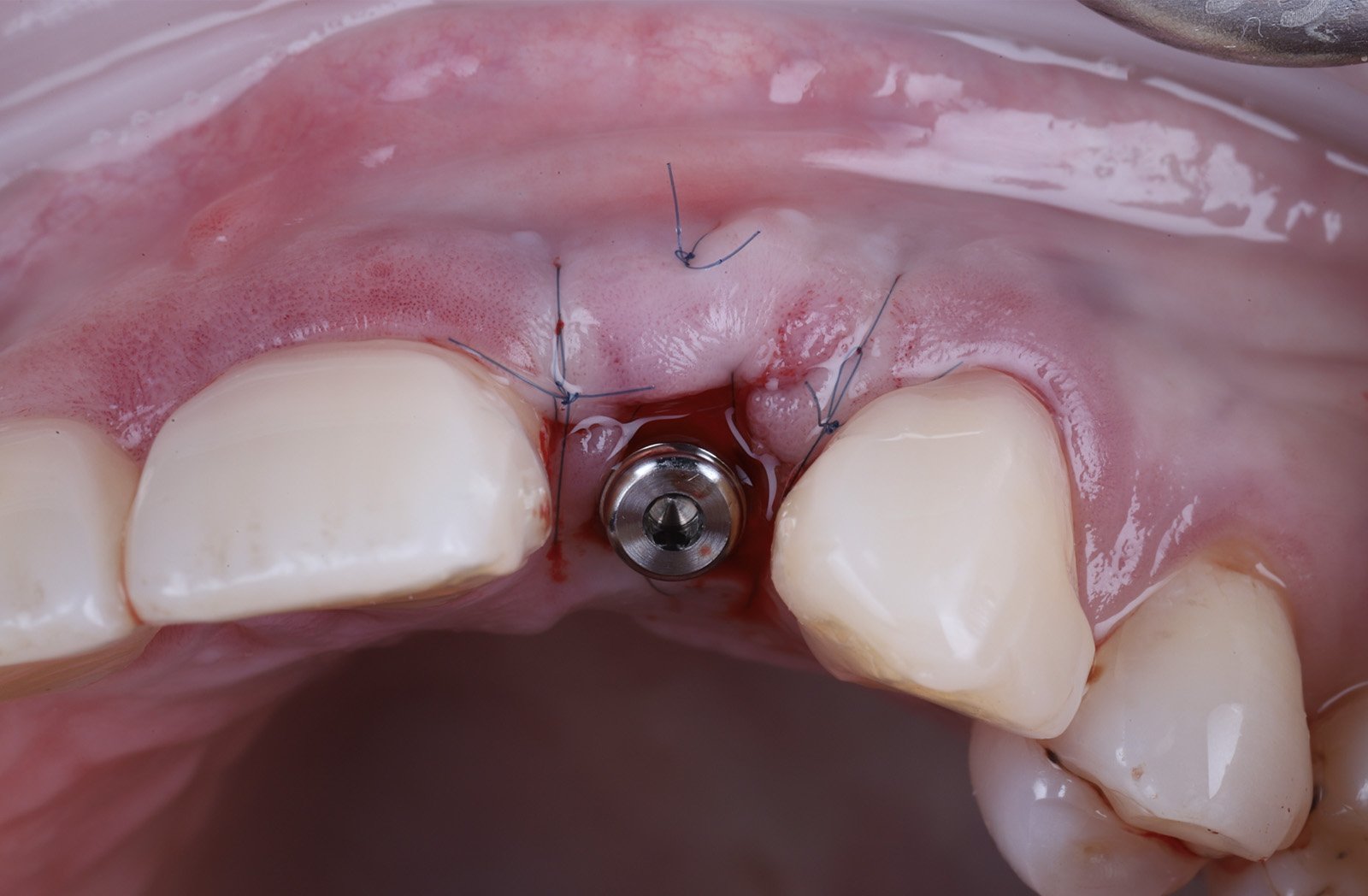 Implantology 2