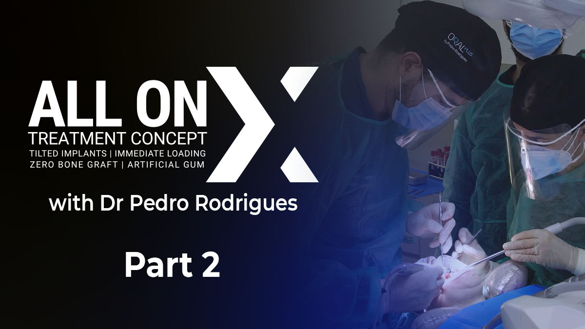 All On X - Part 2