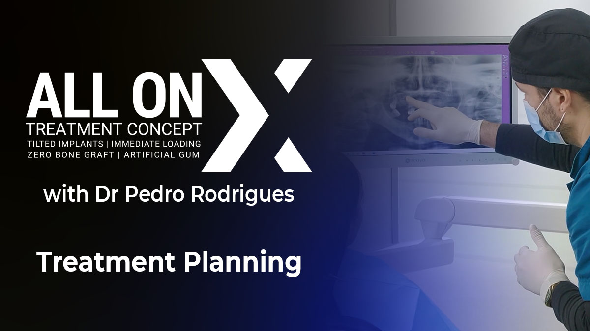 All On X - Treatment Planning