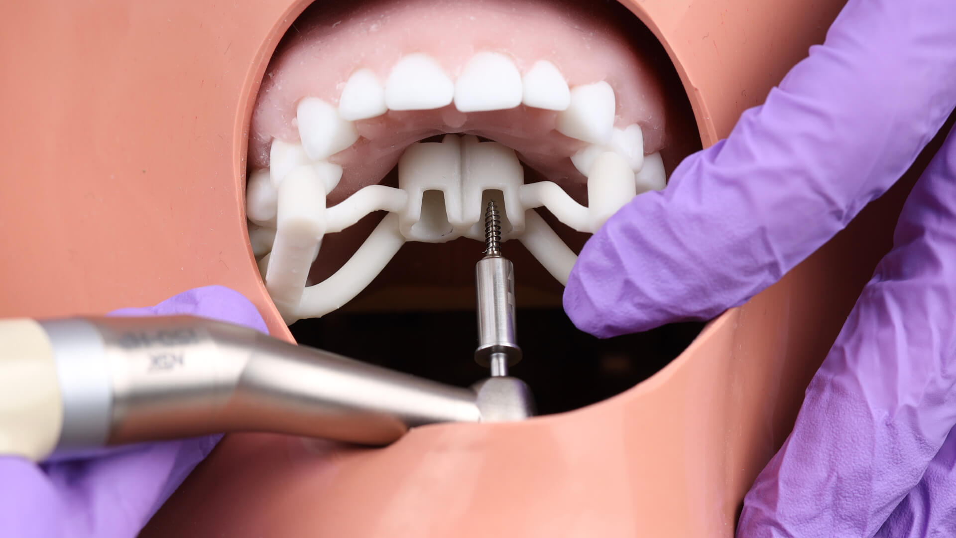 Landing Page Aligner OrthodontiST course.007 Landing Page Aligner OrthodontiST course.007
