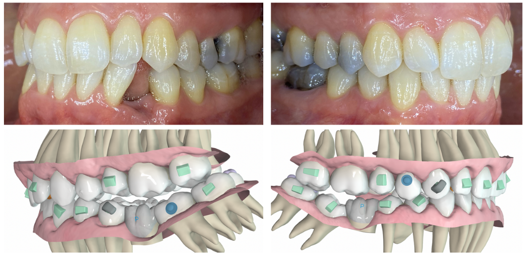 MKT 240112 FAO Case Discussion teeth MKT 240112 FAO Case Discussion teeth
