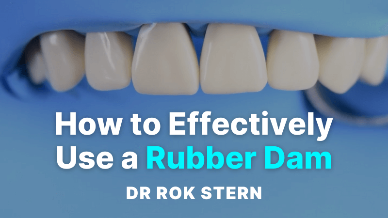MKT-240223-Rok Thumbnail How to effectively use a rubber dam 800