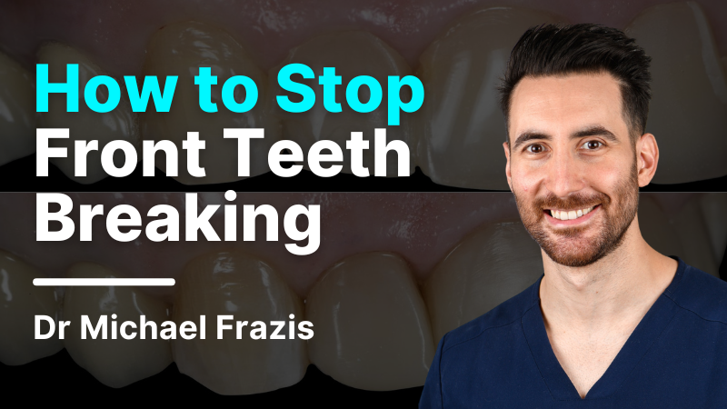 MKT-240405-Frazis Website Thumbnail How To Stop Teeth Breaking 800