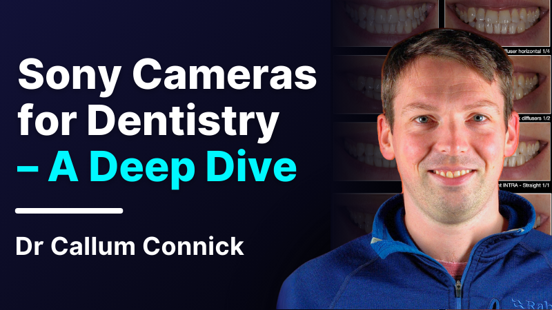 MKT-240427-Callum Website Thumbnail Sony Cameras